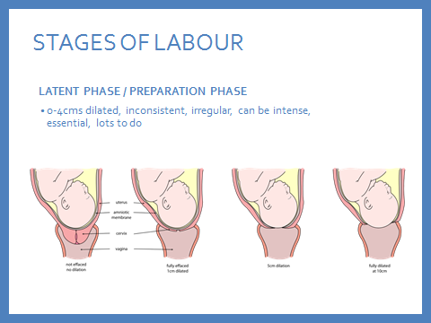 Stages of labour1.png